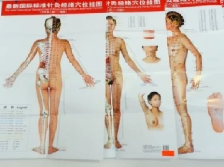 Acupunctura face parte din universul extrem de vast al medicinei traditionale