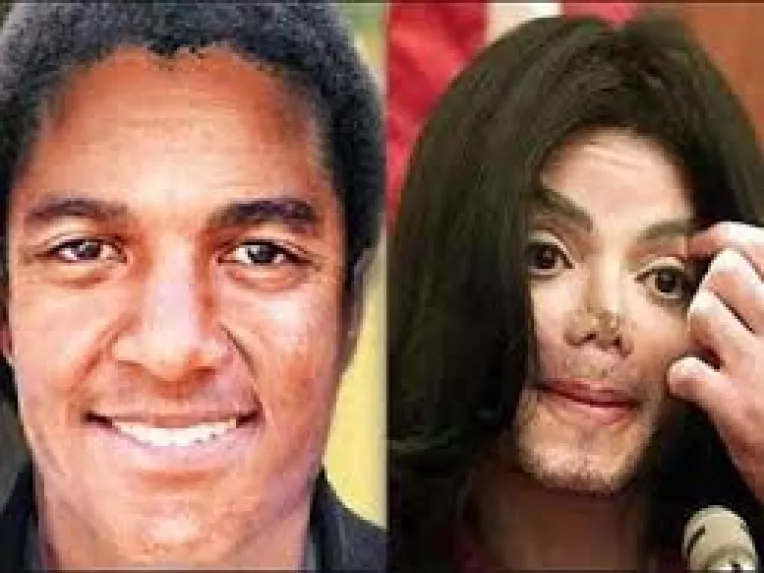Michael Jackson, fara operatii de chirurgie estetica